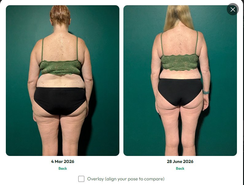 Before and after: back-view progress photos from 4 March to 28 June 2026, shown in Evolve's Compare view